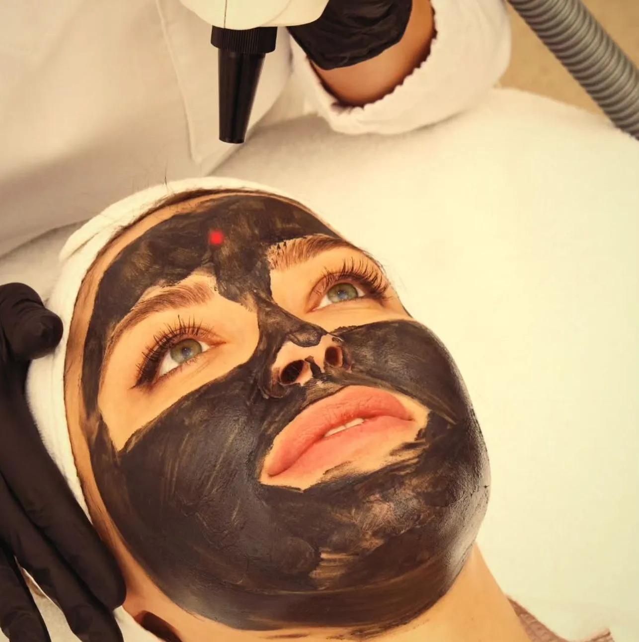 Cochrane SACN | How Long Does Carbon Peel Recovery Take? Multiple Mild Peels Over One Harsh Treatment