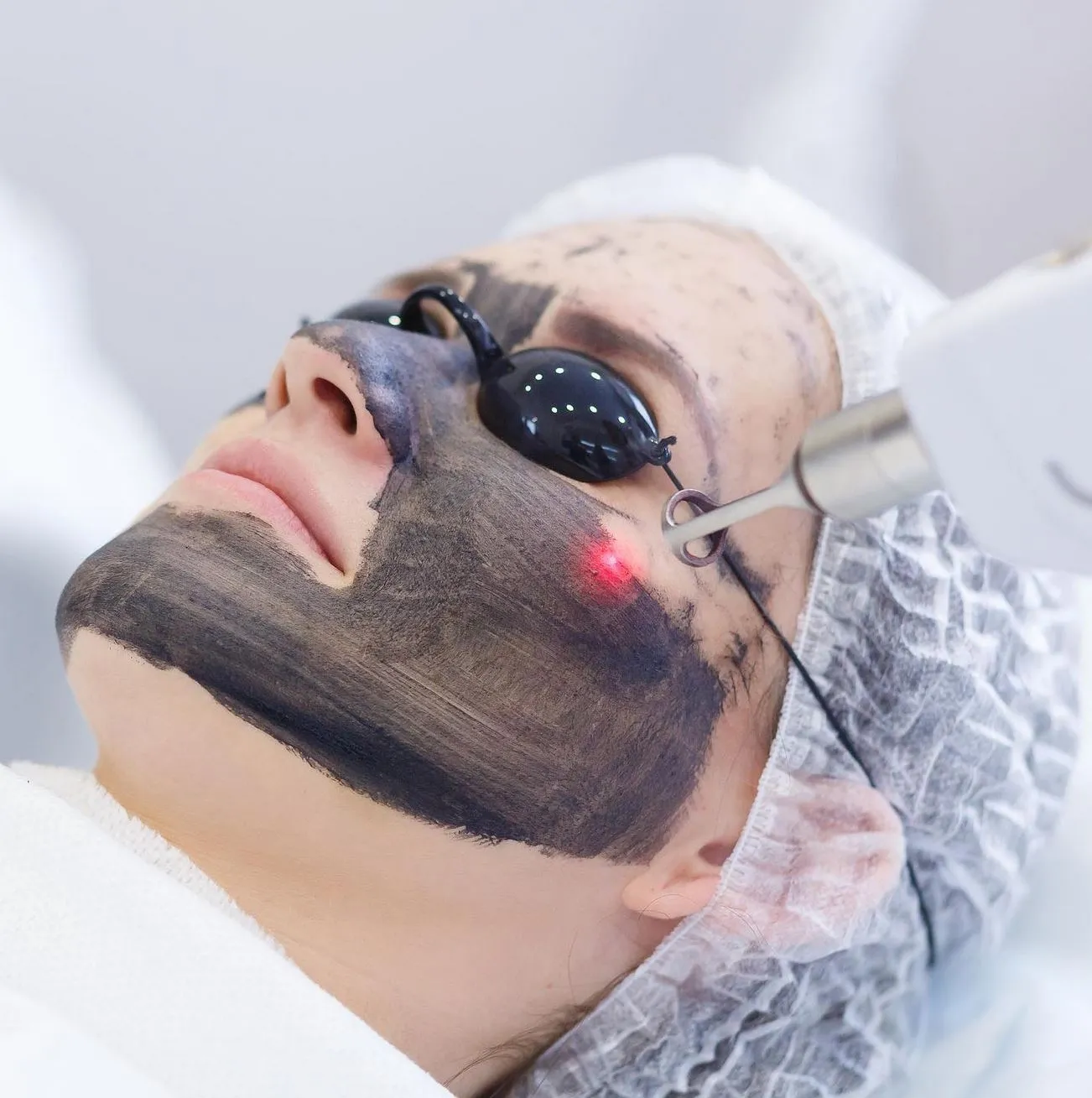 Cochrane SACN | How Long Does Carbon Peel Recovery Take? The Facial Hub facial studio