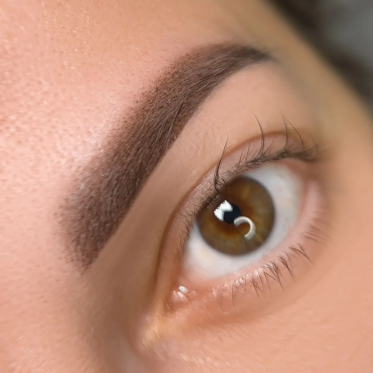 Why Brisbane Skin Needs Special Care