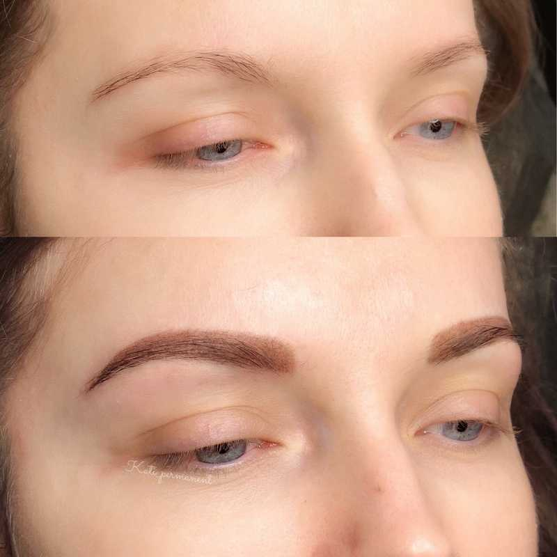 Utilization of saline for eyebrow tattoo removal